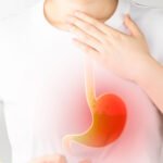 GERD dan penyakit jantung