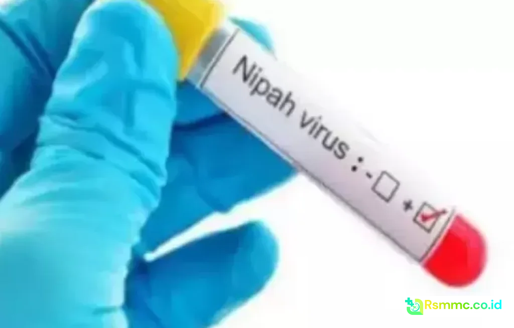 Gejala Virus Nipah Mematikan