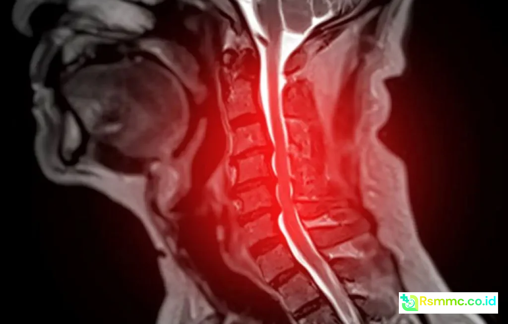 AI Spinal Cord Disease Prediction