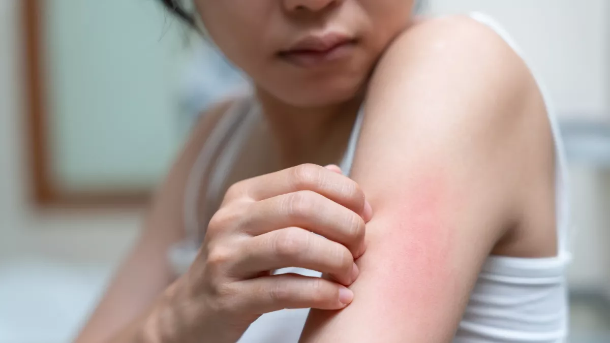 Penyakit Kulit, Gejala dan Jenis Jenisnya yang Perlu Diwaspadai