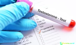 low testosterone prostate cancer