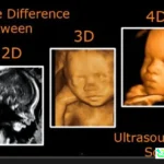 USG 2D dan 4D