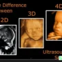 USG 2D dan 4D