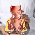 Penyebab Ambeyen yang Sering Diabaikan, Kenali Sebelum Makin Mengganggu