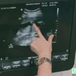 radiologi RS Permata Gunung Putri