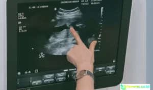 radiologi RS Permata Gunung Putri
