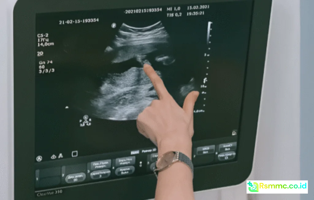 radiologi RS Permata Gunung Putri